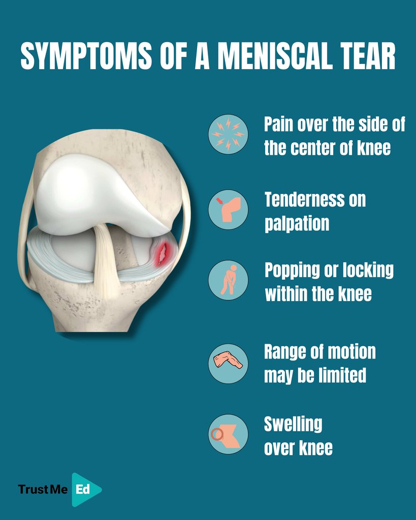 ⛹️ A torn meniscus is one of the most common knee injuries. Athletes, especially those that play in contact sports, are at risk for meniscal tears.

You can watch the full lecture by Prof. Jonas Thorlund here 👇

🔗 trustme-ed.com/lectures/menis…

<a href="/jbthorlund/">Jonas Thorlund</a>