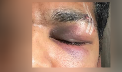 UKCorruptPolice's tweet photo. Racist attack Ormskirk, Lancashire police close the case stating they CANNOT identify the attacker. BULLSHIT. They have the attacker's photo and car reg. @BBCLancashire @LancsPCC https://t.co/DStJJxTOr0
