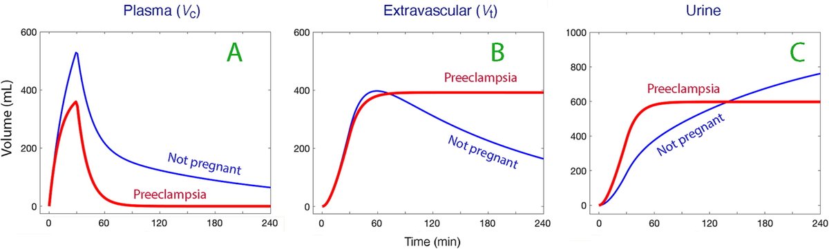 Maldistribution of fluid in preeclampsia: a secondary kinetic analysis 🚰Hypovolemia + edema common in pre-eclampsia 🚰Rate of distribution of fluid normal 🚰Return flow from interstitial space to plasma #OpenAccess #FOAMed #ObAnes #preeclampsia doi.org/10.1016/j.ijoa…