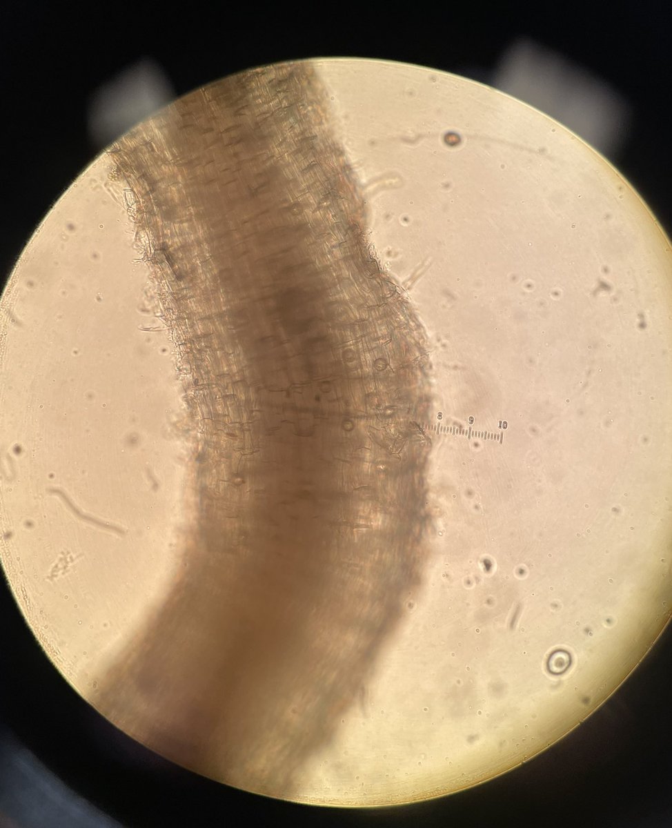 An eventful day behind the microscope finally confirming isolation of Rapid Blight pathogen L. terrestris + a bonus pic of some gnarly Pythium oospores.