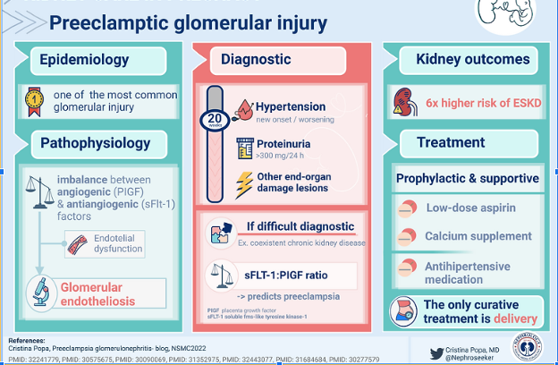 T0a: Let’s start with a brief introduction of key facts in pre-eclampsia. ✍️ In a nutshell, here is a beautiful 🪧 infographic by @nephroseeker @KIreports #NephJC