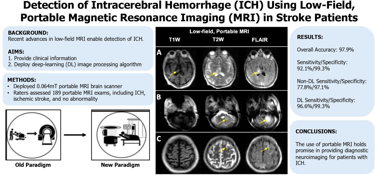 Article Commentary: 'Detection of Intracerebral Hemorrhage Using Low-Field, Portable Magnetic Resonance Imaging in Patients With Stroke' ahajournals.org/do/10.1161/blo… In this #BloggingStroke post, Courtney Curran discusses #Stroke article by @MercyMazurek et al.