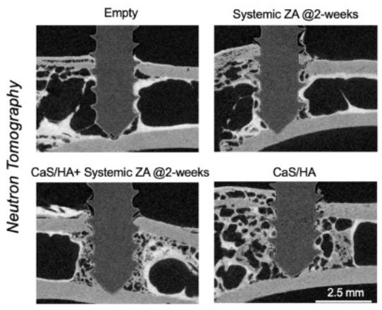 Congratulations Deepak Raina and collaborators, and thanks for involving @Lund_BioMech on this huge adventure! New study in @ActaBio presenting how systemically administered zoledronic acid activates peri implant bone formation sciencedirect.com/science/articl…