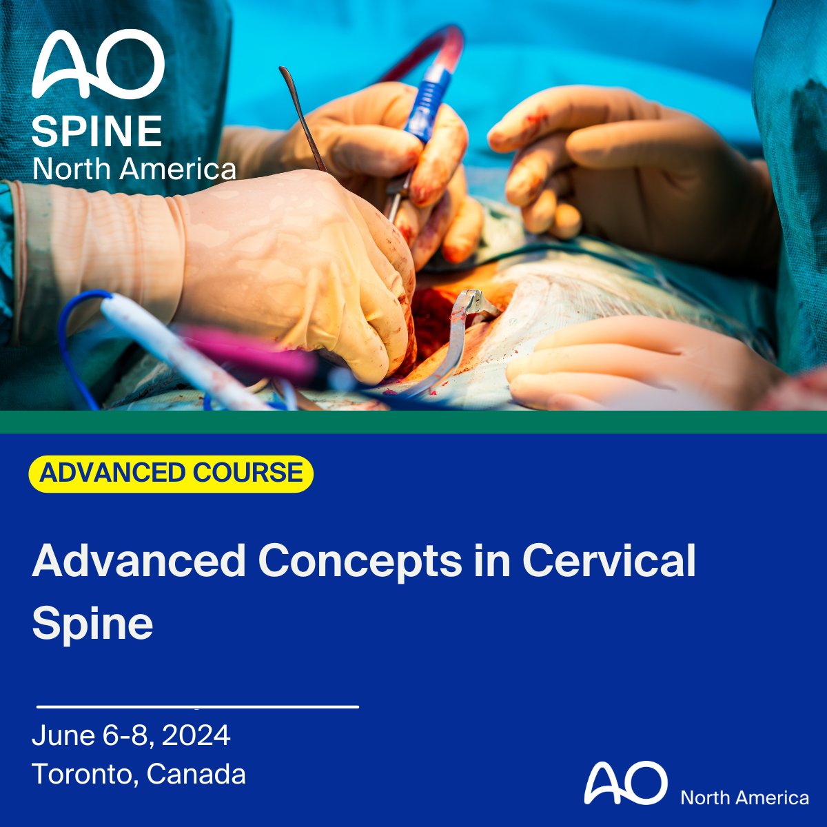 Join us for the Advanced Concepts in Cervical Spine course in Toronto, Canada on June 7-8, 2024. @AOSpine For more information and to register, please visit: bit.ly/SpineAdvConcep…