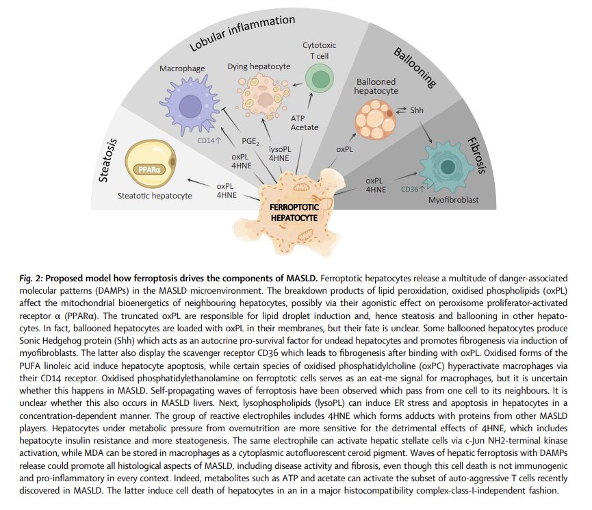 A brilliant @eBioMedicine review article on the emerging role of #ferroptosis in metabolic dysfunction-associated steatotic liver disease: revisiting hepatic lipid peroxidation→jmp.sh/5UWLwaTA via Cédric Peleman @FrancqueSven @TomVBerghe #livertwitter #MASLD #MASH #HCC