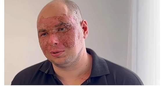 MykhailoRohoza's tweet photo. This Is Olexander Dontsov. Having lost a fellow lifeguard and suffered injuries, he continued to rescue people after the rocket arrival in Odessa on March 15. A hero.🇺🇦 https://t.co/3y7rPUy2Q3