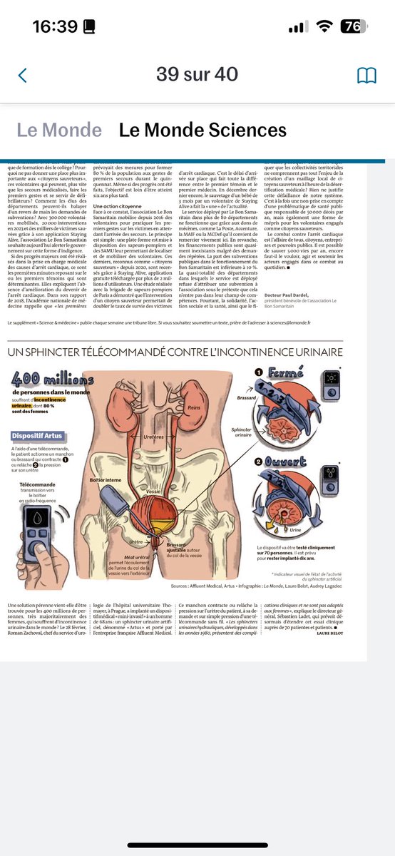 svklvo's tweet image. UN #SPHINCTER #TÉLÉCOMMANDÉ CONTRE L&apos;#INCONTINENCE_URINAIRE