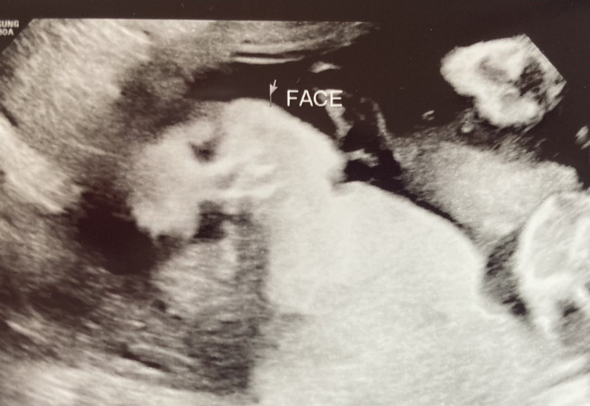 xoPinup's tweet photo. Probably the last pictures of Ace I will get until he’s born. I miss him already 🥹. https://t.co/ftzLz8iq0k