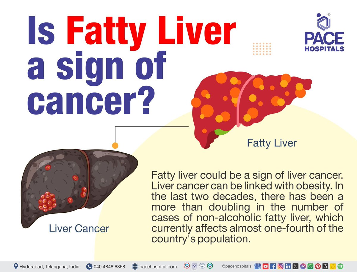 #Livercancer refers to the abnormal growth of cells within the #liver, leading to the formation of a #tumor. 

Know more: bit.ly/4a9SaMe

#livercancerawareness #liverdisorder #liverproblems #fattyliver #HPB #hepatology #hepatologist #livertransplantsurgeon #pacehospitals