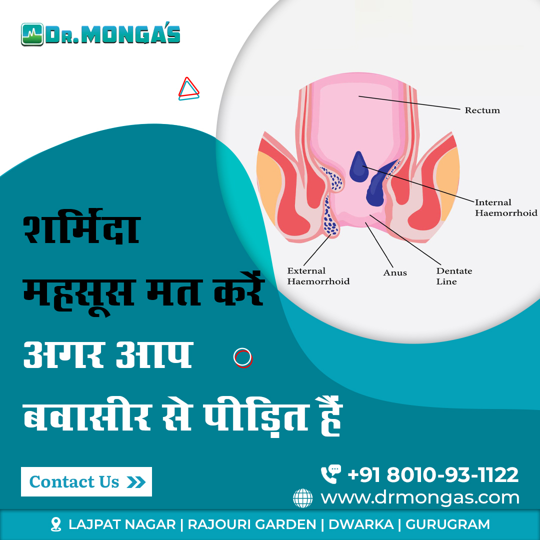 'Find relief from piles with expert treatment at Dr. Monga Clinic in Delhi. Our personalized care and advanced therapies ensure lasting comfort. Book your consultation now for effective relief. #PilesTreatment #Delhi #DrMongaClinic #Healthcare'