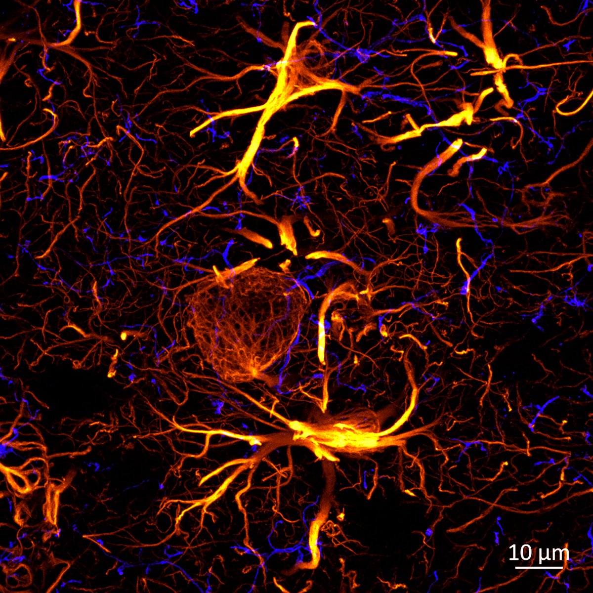 Oof, what these astrocytes are doing? They stole the show in this case; microglia are barely appearing 🔵microglia (iba1)🟡astrocytes (gfap) #neuroscience @zeiss_micro