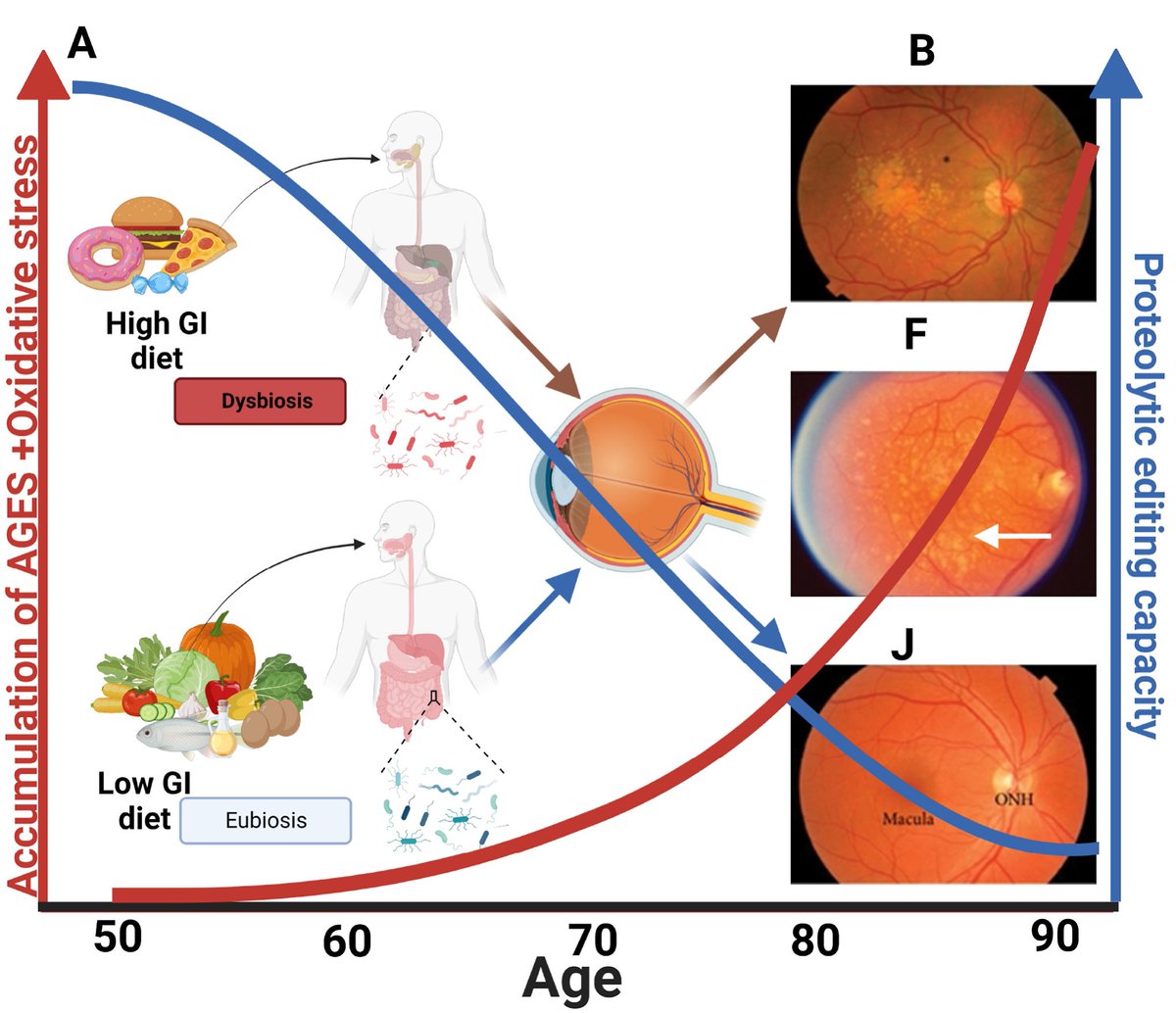 New article in #PRER from Allen Taylor and colleagues from @TuftsNutrition and @uchceu. They explore the links between diet, metabolism and eye disease. Focus is on high glycemic index, glycative stress, AGEs and #maculardegeneration  @ELSneuroscience sciencedirect.com/science/articl…