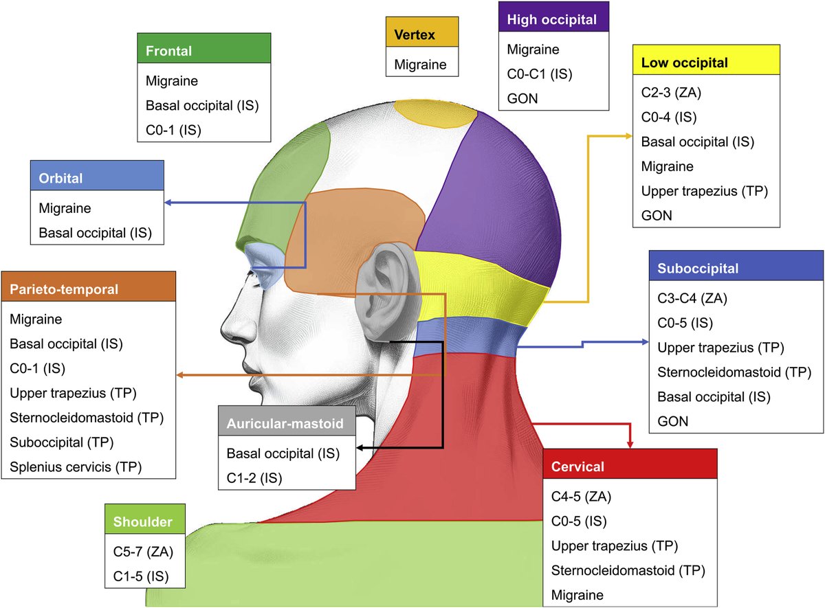 Causes of headache and neck pain according to the affected site 🤕

👇👇👇

pubmed.ncbi.nlm.nih.gov/38388233/