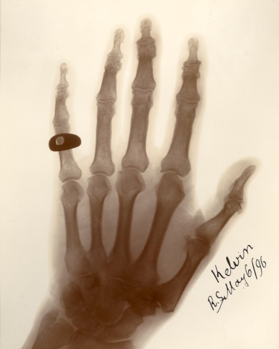 Born #OnThisDay in 1845 was Wilhelm Röntgen, the German physicist who first identified X-rays, for which he won the first Nobel Prize in Physics in1 901. The X-ray below shows the hand of Lord Kelvin, complete with signet ring, and was taken at the Royal Society in 1896. #Physics