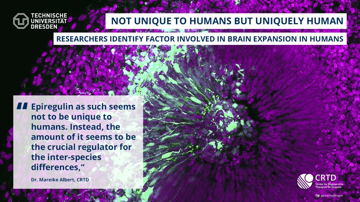 Ever wondered what makes us uniquely human? It might just be our neocortex!🧠 Researchers, led by @MareikeAlbert at @CRTDpress @tudresden_de, unveil a factor that could have fueled neocortex expansion in humans. Read more ➡️ bit.ly/4atdImx #CMCBnews