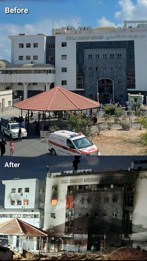 Two photos illustrating the severe damage inflicted on Al-Shifa Hospital by #Israeli occupation forces. PALYOUTH .H.B