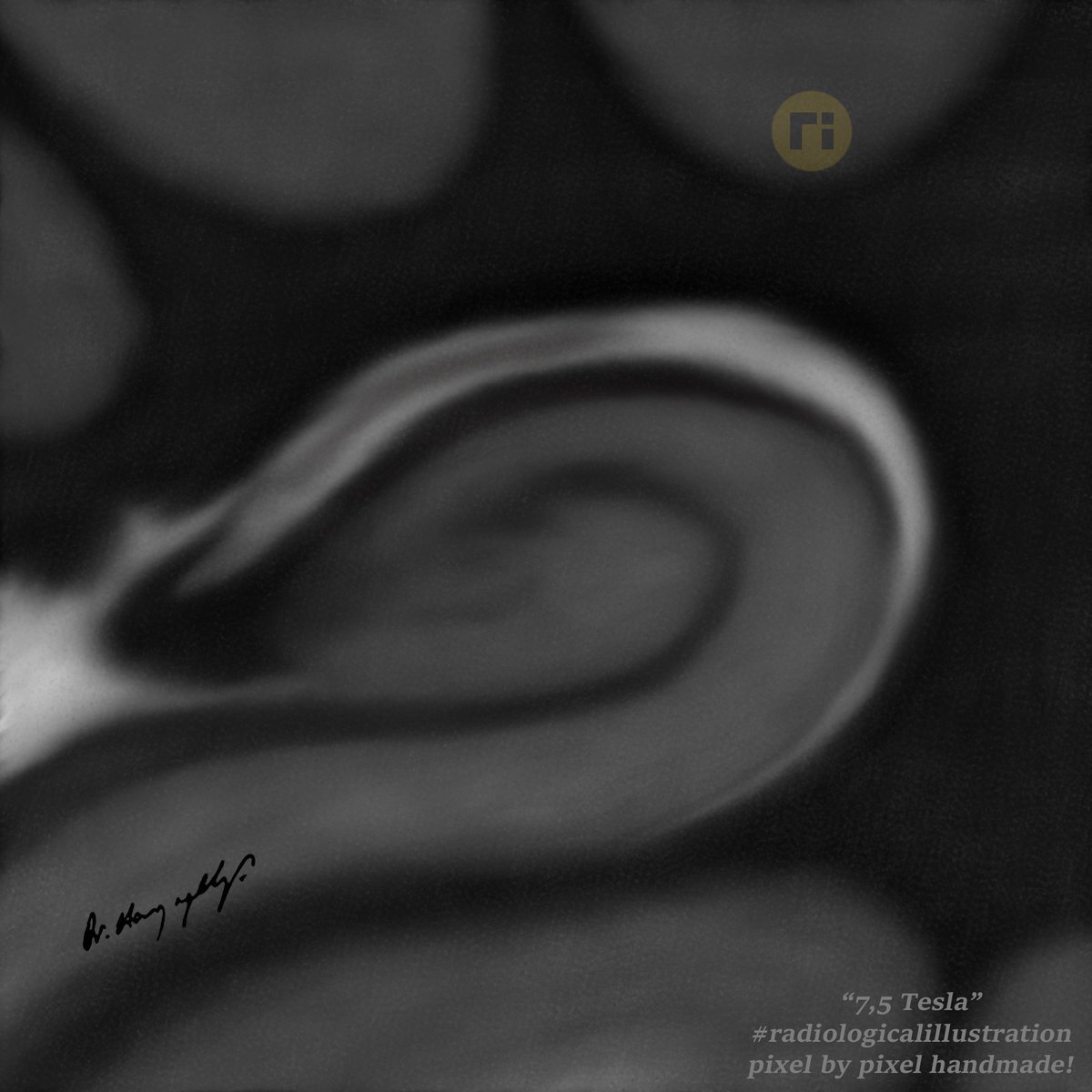 Hippocampal Formation #radiologicalillustration ✍️ pixel by pixel handmade!