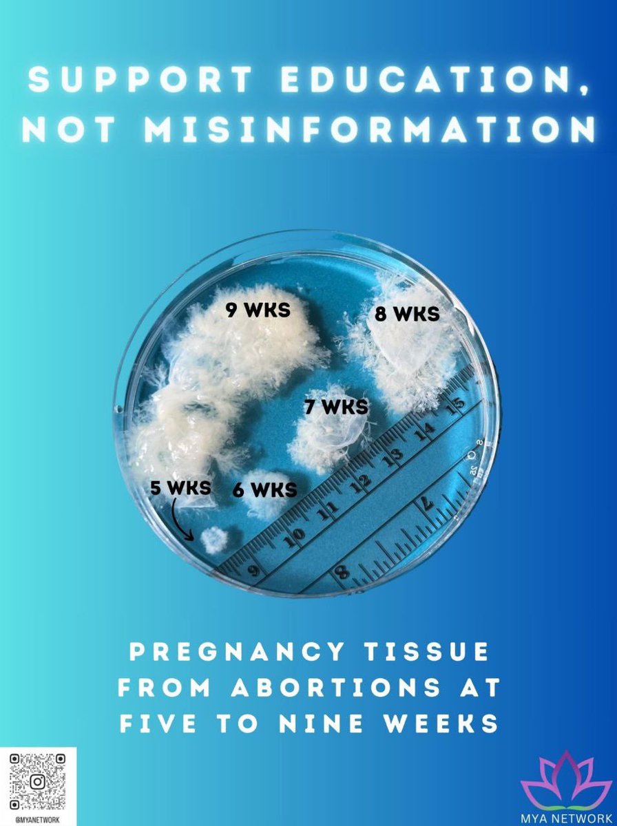 Как выглядели бы плакаты с реальными эмбрионами а не той мутью которую продвигает пролайф: