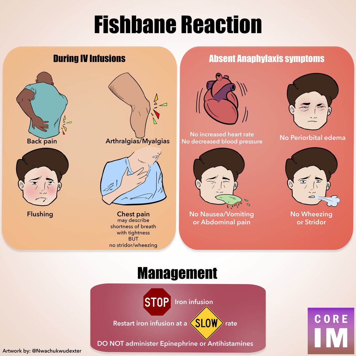 5/ IV iron is a SAFE treatment option!

⚠️ Fishbane reaction is a minor and self-limited infusion reaction. 

It is NOT IgE mediated!

**Do NOT administer epinephrine or antihistamines** ‼️