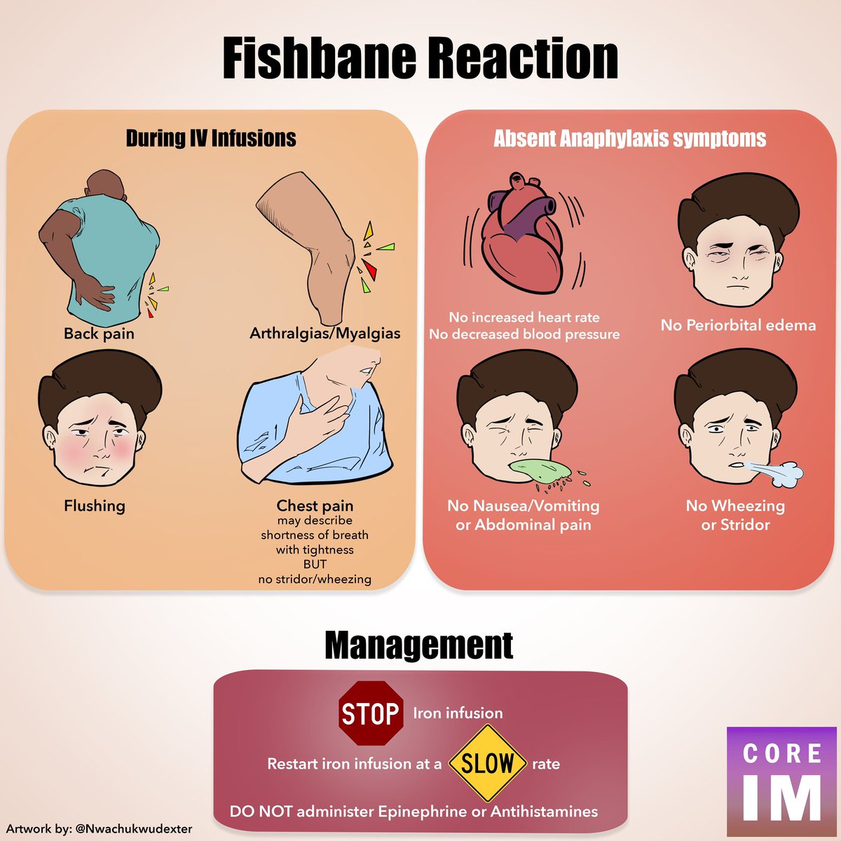 5/ IV iron is a SAFE treatment option! ⚠️ Fishbane reaction is a minor and self-limited infusion reaction. It is NOT IgE mediated! **Do NOT administer epinephrine or antihistamines** ‼️