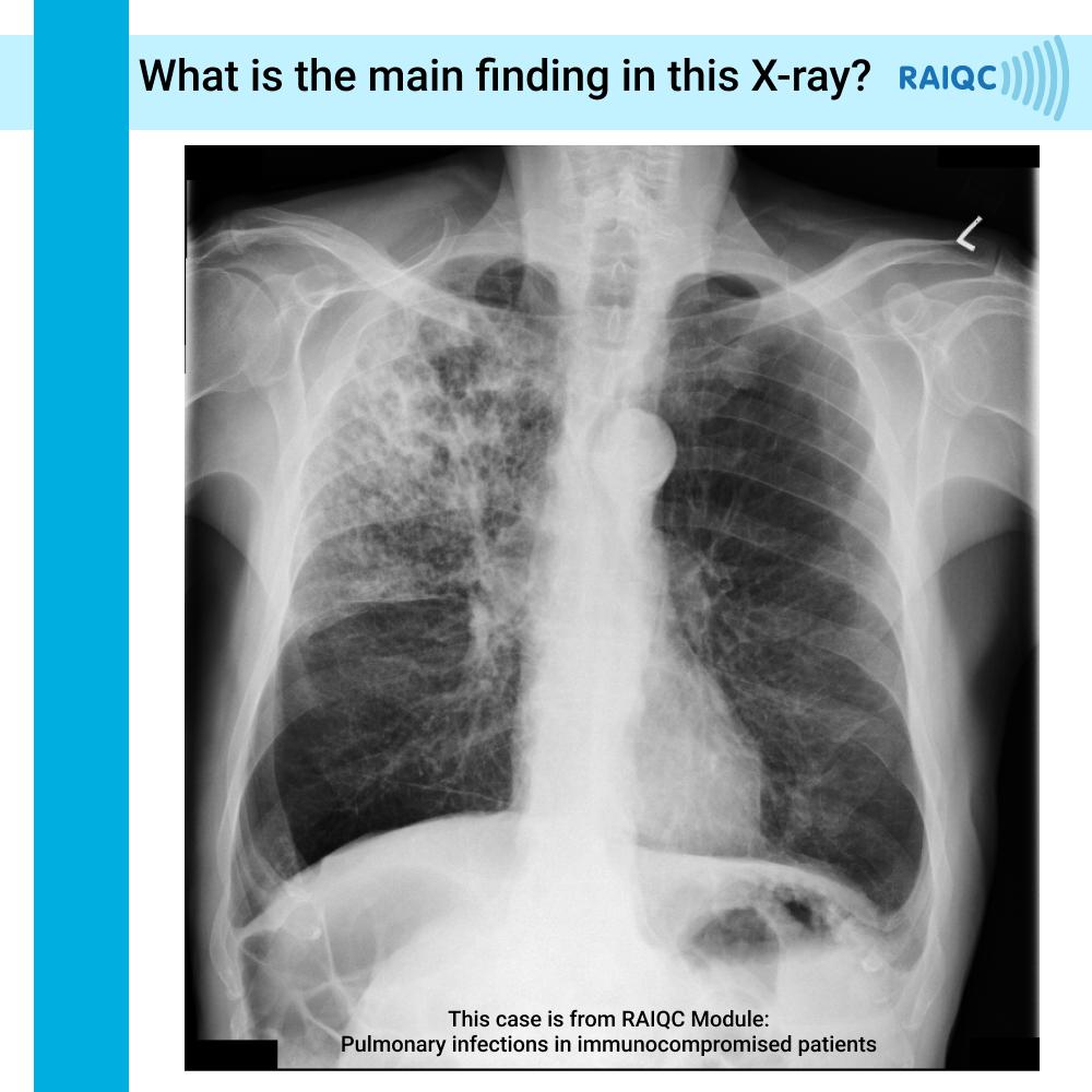 Post your answer in the comments ✏ We'll post the answer in 24 hours! For more cases like this, check out our educational package at raiqc.com