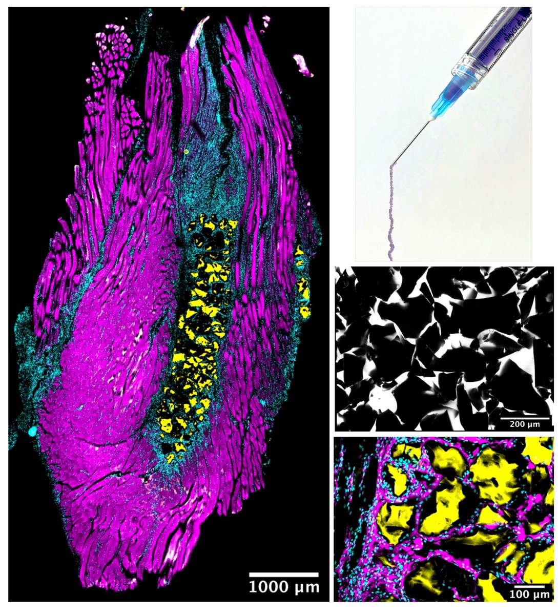 Excited to share the lab's 1st research ppr published in @AdvSciNews Advanced Healthcare Materials. Super work from undergrads @ellietanner614 Leia Schiltz & Niharika Narra, showing granular hydrogels support myogenic repair after volumetric muscle injury @PurdueBME @MYOTWlTTER