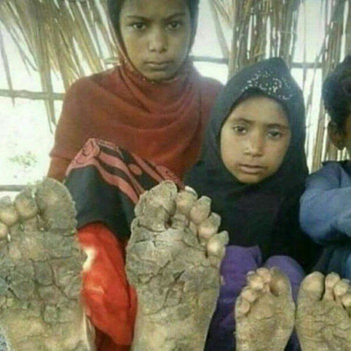Seeingidoc's tweet image. 🇮🇷 The children of Iran don’t have shoes to wear because the Islamic Republic steals their money and sends it to Gaza, Yemen, Lebanon, Syria, Iraq to enrich terrorist leaders and sponsor the killing and kidnapping of civilians. #EndIRGC #PahlaviReturn