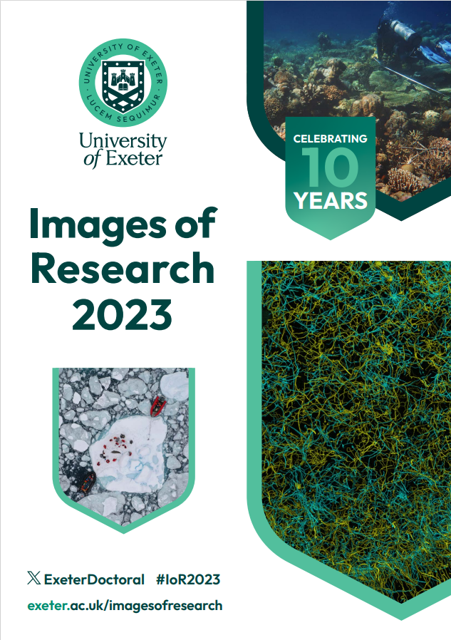 Sir_HayWizzy's tweet photo. Images of Research | Early career researchers | @universityofexeter
Barely a month after the commencement of my Ph.D. studies, I entered the 'Images of Research' competition. 
#phd
#medicalstudies
#fibroblasts
#fibrosis
#pulmonaryfibrosis
#mechanotransduction
#universityofExeter https://t.co/ORgqurbnsa