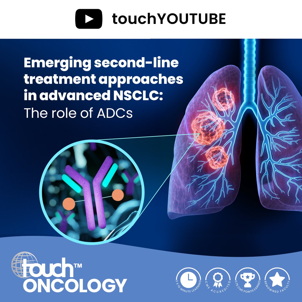 Have you seen our latest #YouTube video? Emerging second-line treatment approaches in advanced NSCLC: The role of ADCs Watch now: youtu.be/sgqnNm-9bwY #LungCancer #Lung #NSCLC #ADCs #CancerResearch
