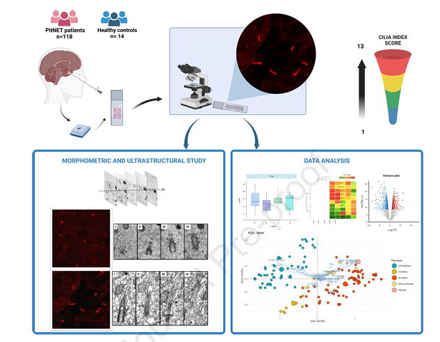 💢Our article in Modern Pathology 👉Primary cilia as a tumor marker in pituitary neuroendocrine tumors 👉👉Our results demonstrate, for the first time, that ciliogenesis is increased in PitNETs👉 potential target for therapy modernpathology.org/article/S0893-… @NeuroendocrinoS