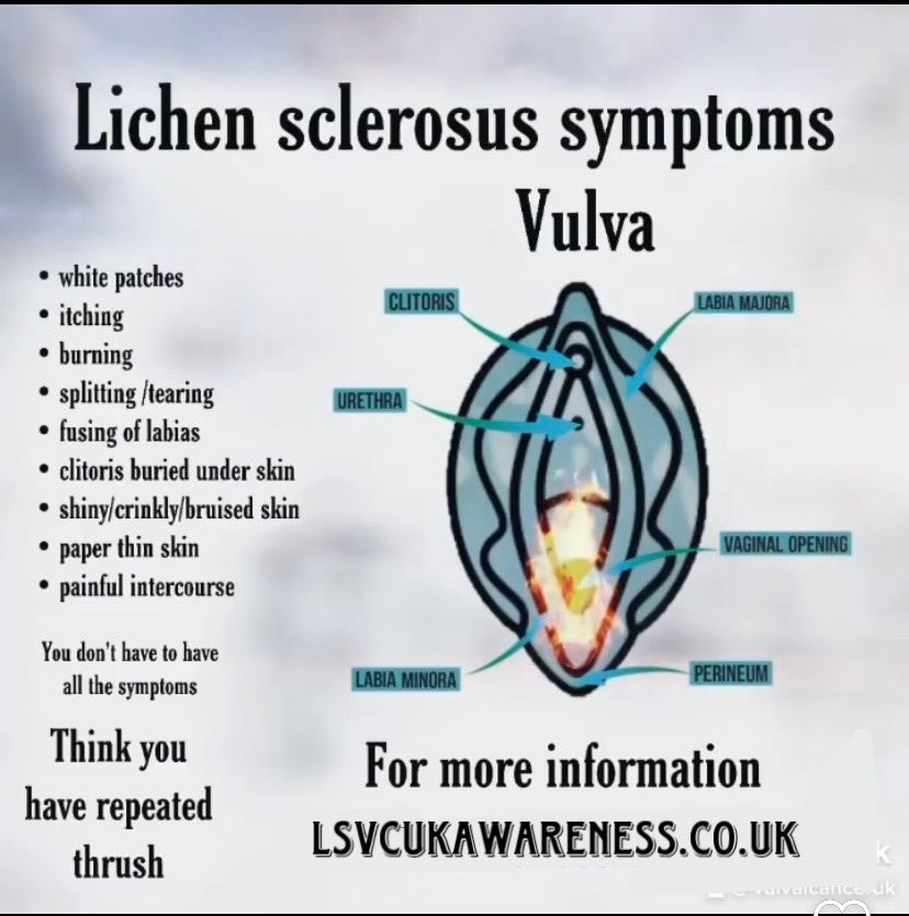 You don’t have to have all the symptoms. 
Itching and white spots/patches are the most common however not everyone has them. 
All you need to know here dermnetnz.org/topics/lichen-…