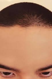 vicotinamide's tweet photo. sorry bat parang kahawig ng noo ni kyungsoo pc yung heatwave sa pilipinas https://t.co/kMKjbqmt2y