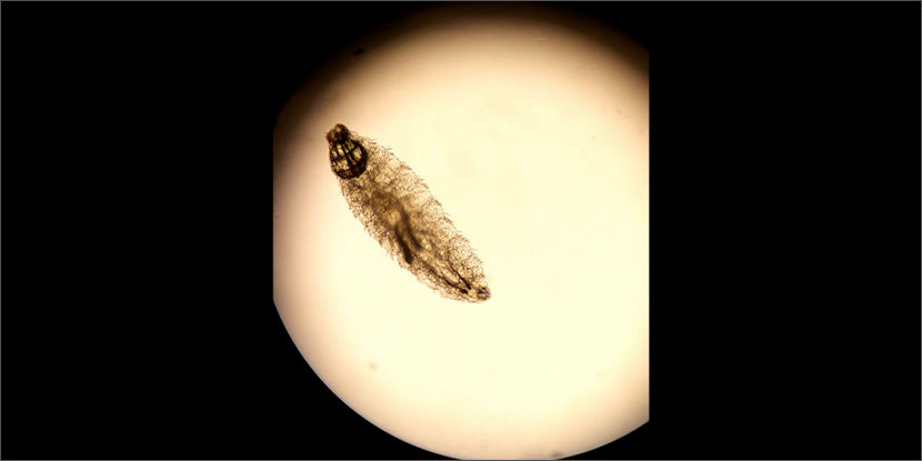 aao_ophth's tweet photo. A sheep #botfly larva wriggles in a young shepherd's eye before being carefully removed with forceps and topical anesthetic https://t.co/iKtdA3GQAN #pathology #cornea https://t.co/qrOK51PUGP