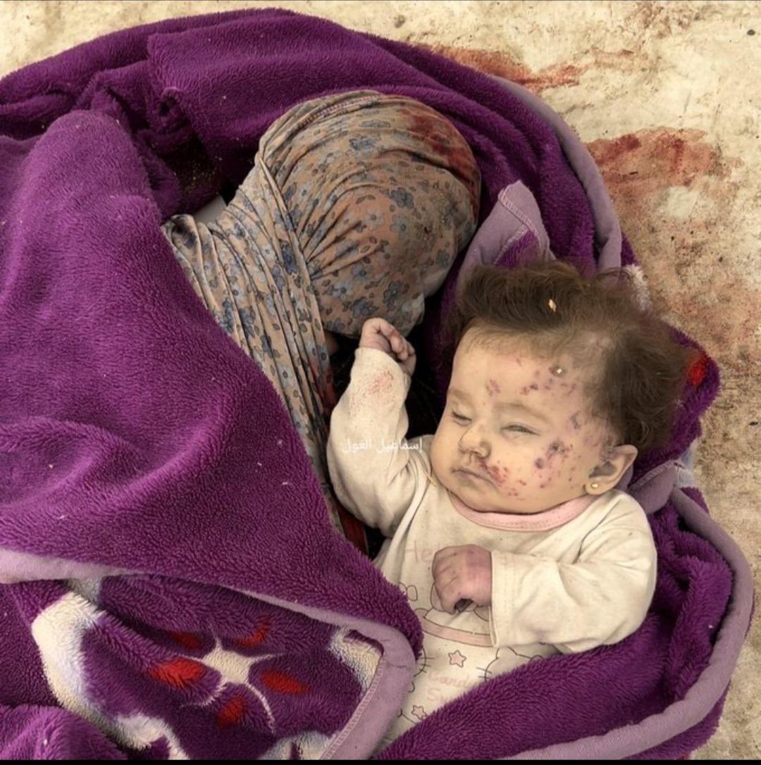 أم وطفلتها 

نحن في غزة لا نقتل فرادى!