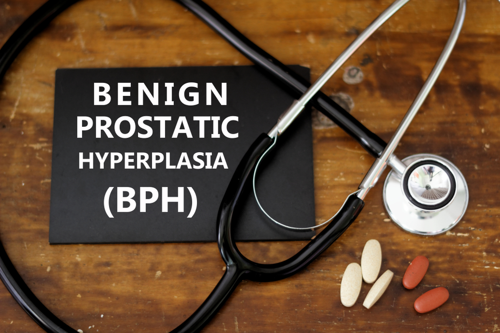 Metformin inhibits #dysregulated sex hormone induced prostatic #epithelial cell proliferation in benign #prostrate hyperplasia patients. Read more in the Journal of Pharmaceutical Analysis: ow.ly/lM8T50QMVzi