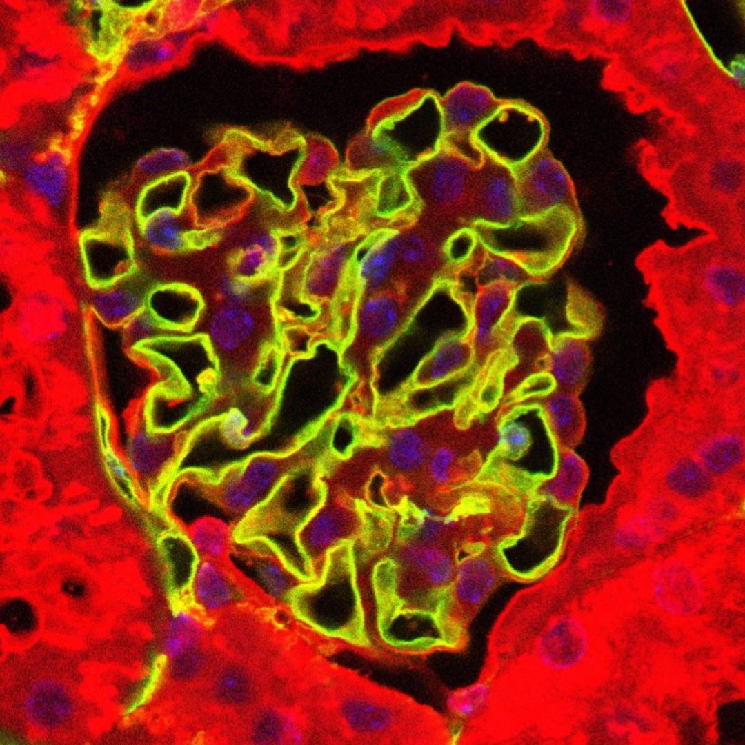 New findings from @BristolUni reveal how hormones can protect blood vessels in kidneys from damage caused by diabetes. This discovery offers a promising avenue for early intervention in diabetic kidney disease. Read the full article below 👇 bit.ly/3xcxOTW