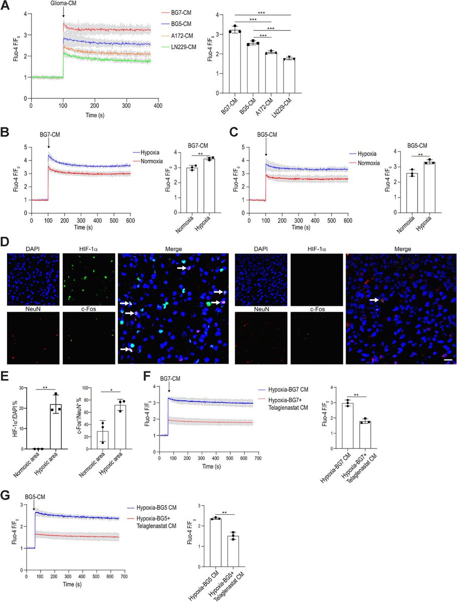 Neuronal activity polarizes microglia in glioma patients. bit.ly/3TUFKly