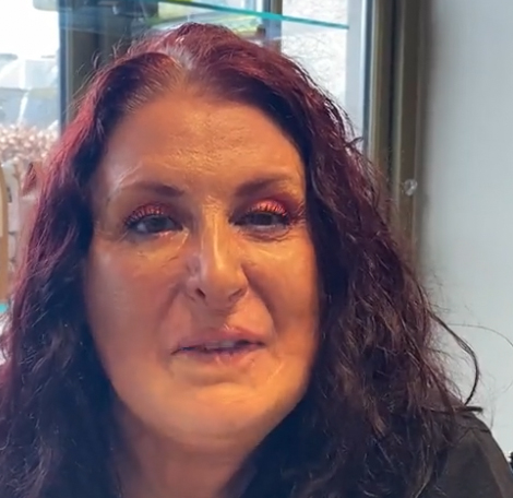 firstpsychology's tweet photo. Michelle Laird was one of our conference speakers, who gave an interesting and emotive talk about her experiences of being a burns survivor. Thank you, Michelle, for joining us on the day and for your lovely words about our conference and our organisation: https://t.co/wRa2OGU1G2 https://t.co/8GPhZpCnzw