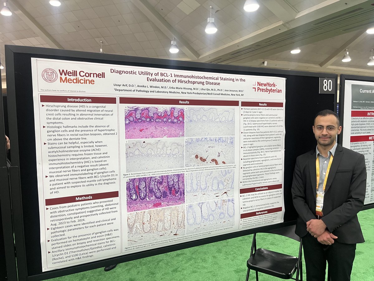 Nice poster by ⁦@WCMCPathology⁩ Resident Uzayr Arif, DO ⁦@TheUSCAP⁩ this morning, “Diagnostic Utility of BCL-1 Immunohistochemical Staining in the Evaluation of Hirschsprung Disease.” #USCAP2024 #PathTwitter #pathology