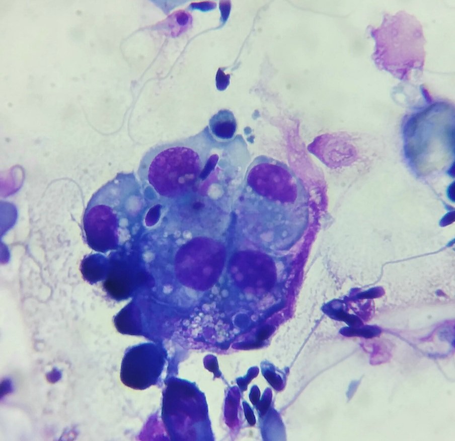 Lisaandrollab's tweet photo. An autoimmune response against any type of infection in the body involves a complex mechanism in which cells, antibodies and various chemical components participate that attack the etiological agent present, to attack the infection. https://t.co/Rvq4ksZtjX