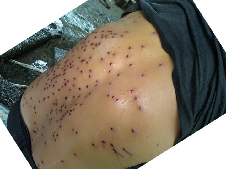 AlvaroAlvaradoC's tweet photo. Que ingratos somos… Si olvidamos la historia, estamos condenados a que se repita. Este es uno de los miles de Bocatoreños que en el 2011, fue reprimido por órdenes de los que gobernaban en ese momento. Estos panameños también valen.
Ministro de seguridad: José Raúl Mulino. https://t.co/z8kyoCdbKd