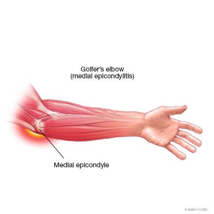 You ever heard the phrase “golfers elbow”? 

Maybe you’ve dealt with it as a baseball player without even knowing. 

Here’s how you can make sure you DONT deal with it: 

(Short Thread)