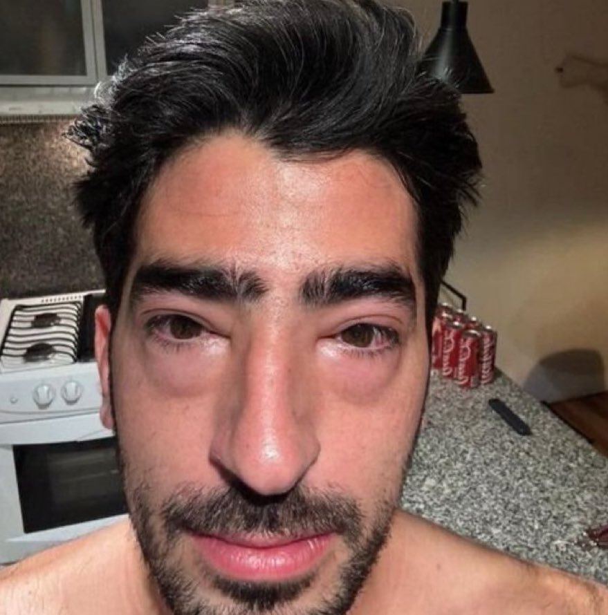 “o choro dura uma noite mas a alegria ela vem pela manhã”

eu de manhã