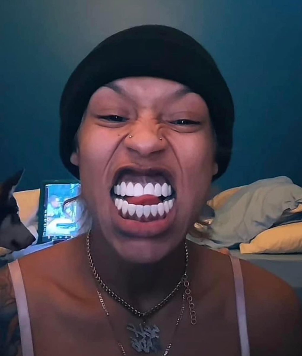 Spin from #JoselinesCabaret shows off her new teeth 🦷