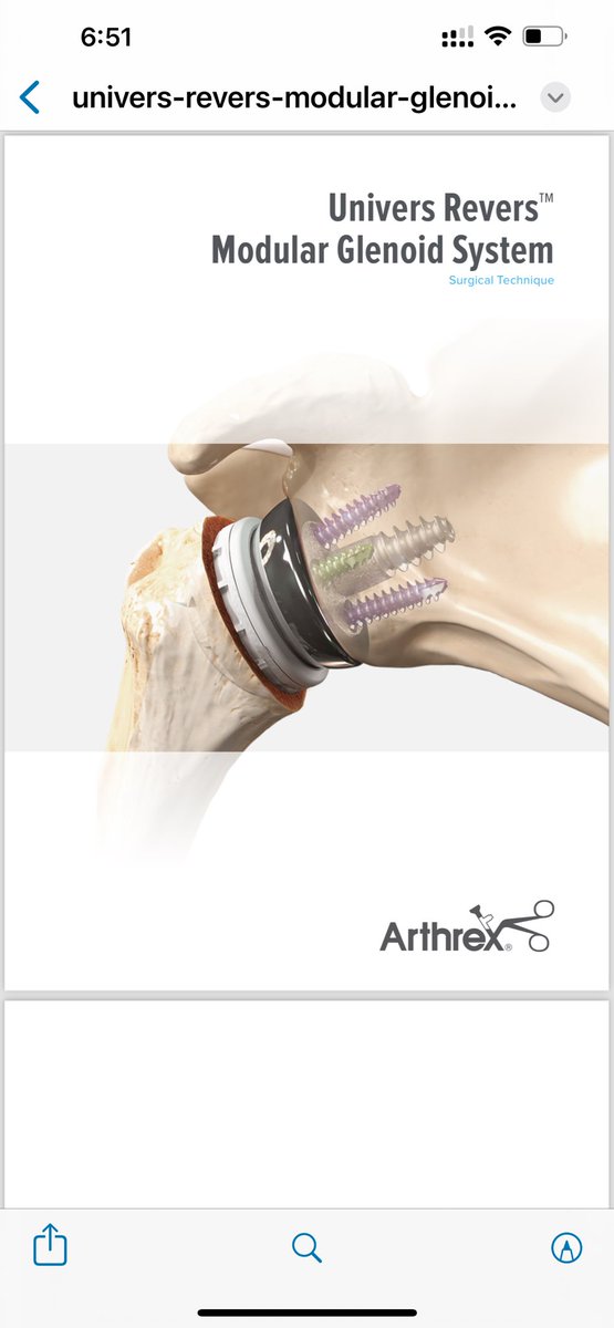 _RamChidambaram's tweet image. Happy to launch Arthrex’s new VIP Reverse shoulder system in India, this being the first live surgery demo of the system in India at GAC, Coimbatore.
This has multiple implant options and comes with Virtual Implant Positioning (VIP) & a customisable guide to improve accuracy.