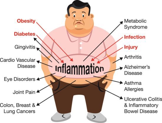 Q: Why do obese people have higher rates of arthritis in their hands and shoulders?

A: Because arthritis is not just a condition of excessive loads on joints causing wear and tear!

ncbi.nlm.nih.gov/pmc/articles/P…