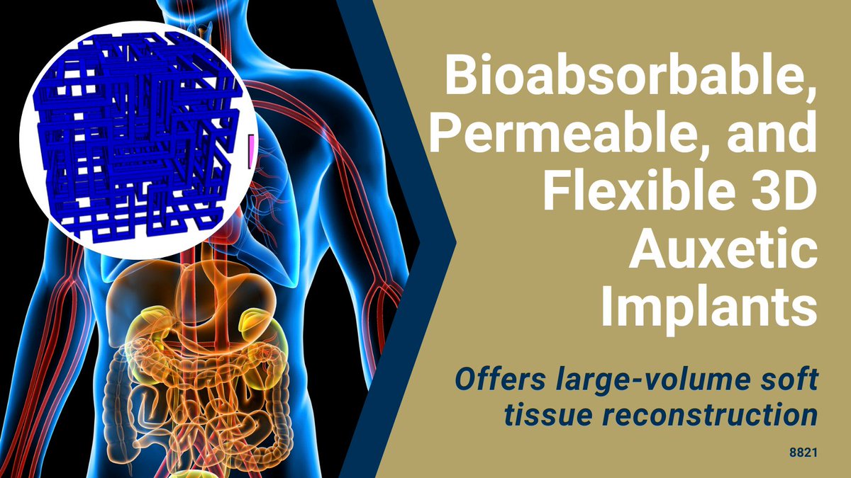 GaTechOTL's tweet image. #AvailableForLicensing: 3D auxetic material with enhanced compressive flexibility, permeability, and nonlinear mechanical behavior can generate implants with living cells that function like natural tissues within the body. #Bioresorbabletissue
@CoulterBME 
ow.ly/vgZQ50PJhIi