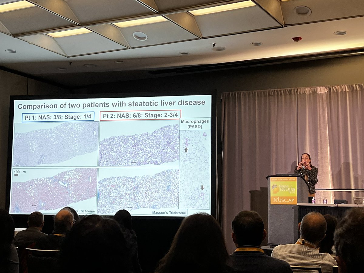 @UTMB_Pathology friend and mentor, @DrHSLovesLiver speaking at the excellent #USCAP2024 Liver Long Course! #liverpath