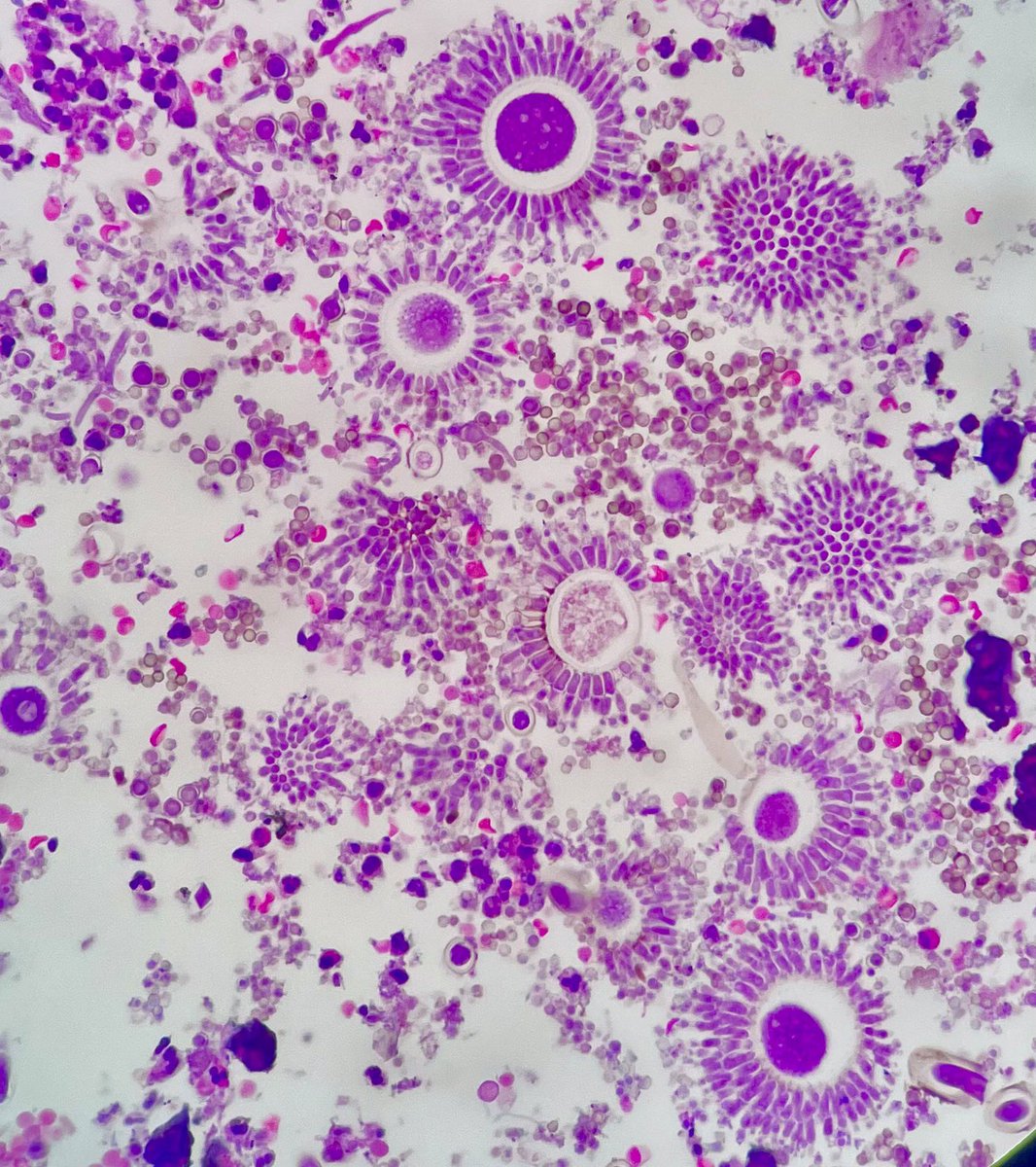 Hashimoto__0's tweet image. Beautiful fruiting heads, isn’t it?
I had to stop for a few minutes and appreciate their beauty🤍