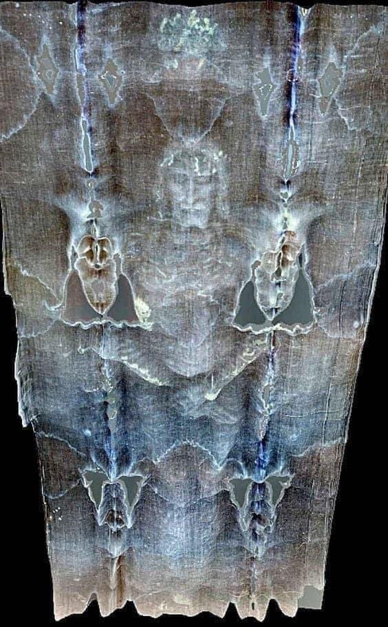 The wounds visible on the Shroud of Turin are all consistent not only with Roman crucifixion, but the details of Jesus’ particular crucifixion like the crown of thorns, no broken bones the scourging and the wound in the side.